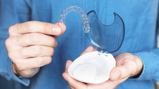 Aligner Braces